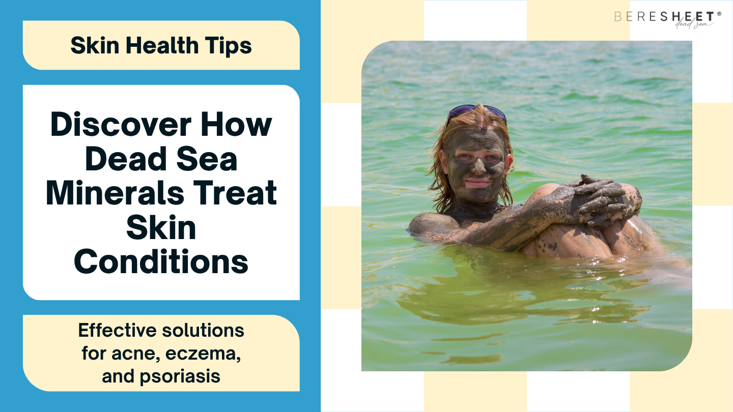 How Dead Sea Minerals Help Treat Acne, Eczema & Psoriasis